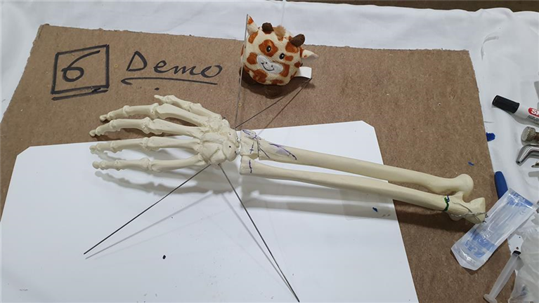 Skeleton Arm Demo